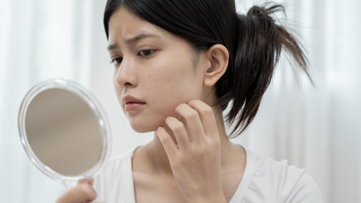 Dermatology Visit for Rosacea Management Near Vienna, Virginia